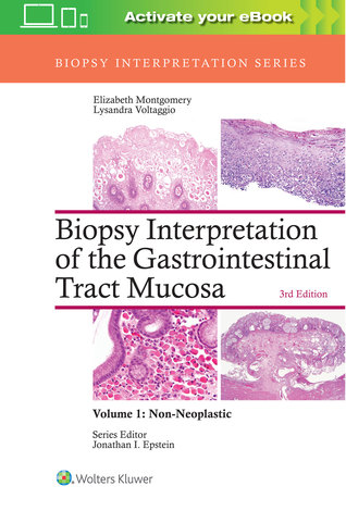 Read Biopsy Interpretation of the Gastrointestinal Tract Mucosa: Volume 1: Non-Neoplastic - Elizabeth A. Montgomery | ePub