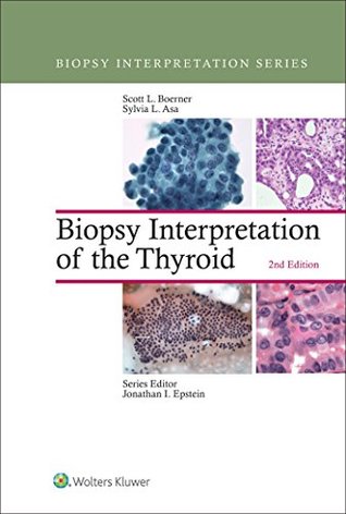 Read Biopsy Interpretation of the Thyroid (Biopsy Interpretation Series) - Scott L. Boerner file in PDF