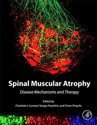 Read Spinal Muscular Atrophy: Disease Mechanisms and Therapy - Charlotte J Sumner file in ePub