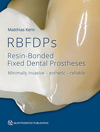 Full Download Rbfdps: Resin-Bonded Fixed Dental Prostheses: Minimally Invasive - Esthetic - Reliable - Matthias Kern file in PDF